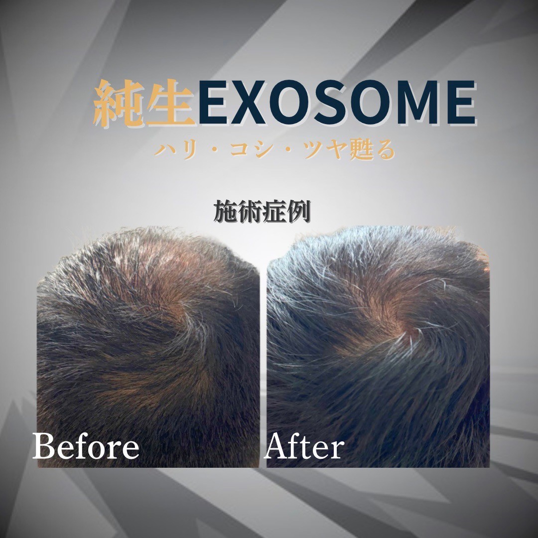 ハリ・コシ・ツヤ甦る