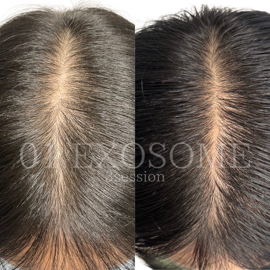 男性の髪の分け目のビフォーアフター