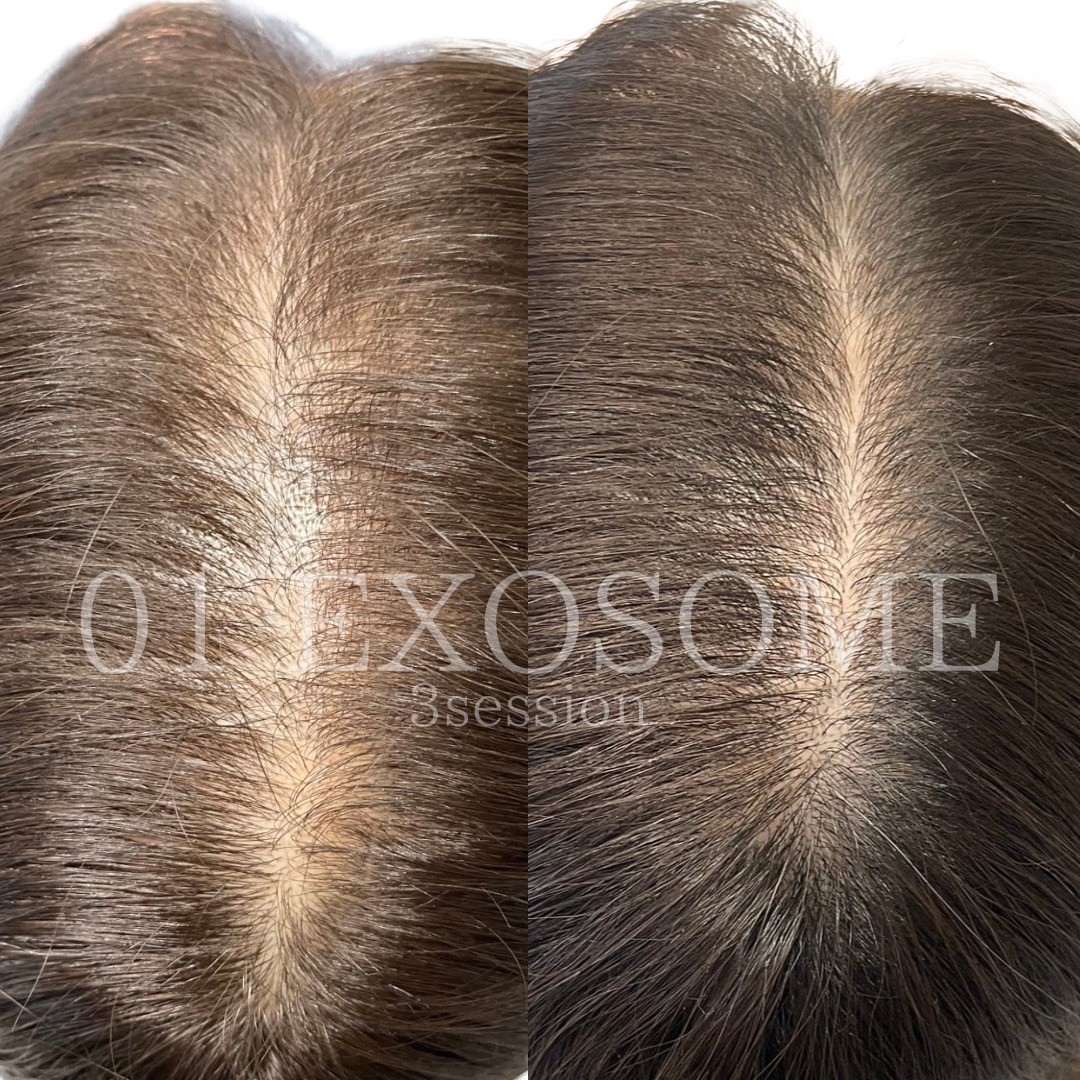 男性の髪の分け目のビフォーアフター