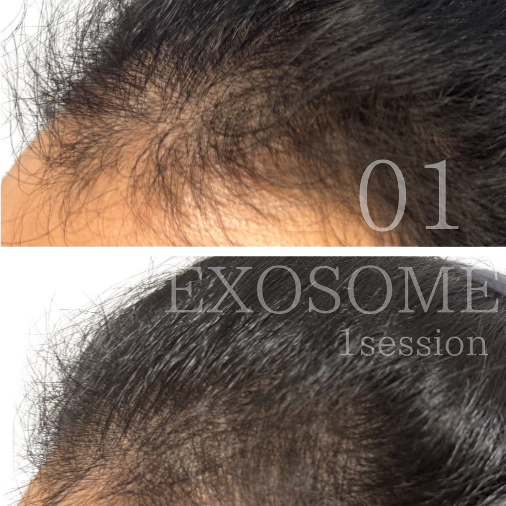 頭部のビフォーアフター