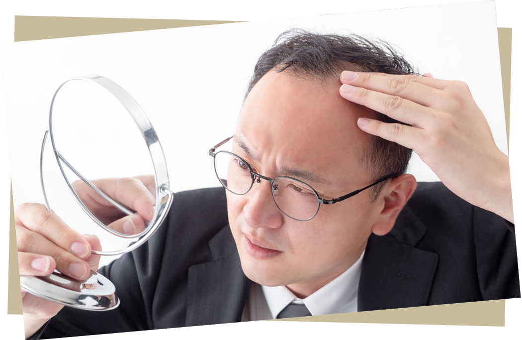 頭皮を気にする男性